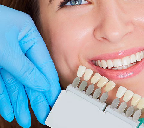 Implantes dentales en Bogotá, paciente con muestras de dientes