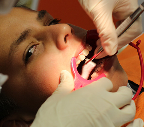 Limpieza dental en Bogotá, odontólogo realizando tratamiento