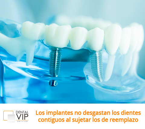 Imagen de Implantes dentales en Bogotá 