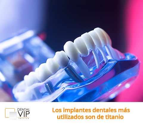  Fotografía de implantes dentales en Bogotá