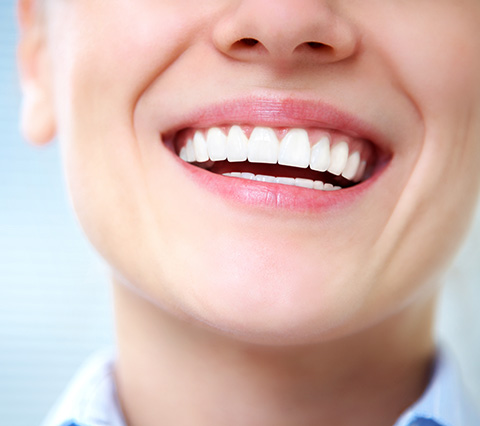 Carillas en Bogotá, persona sonriendo feliz con dentadura blanca