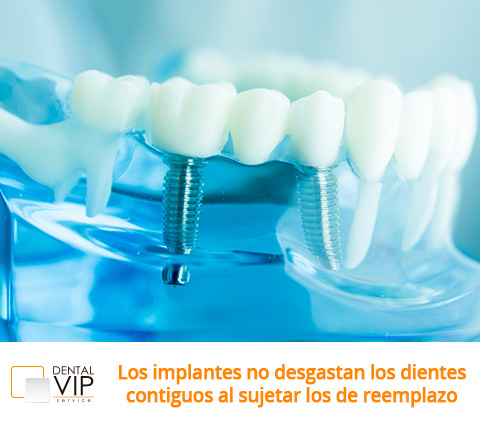 Imagen de Implantes dentales en Bogot 