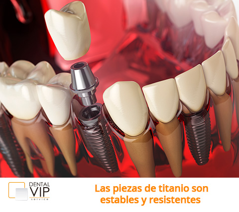 Imagen digital de implantes dentales en Bogotá