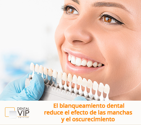 Proceso de blanqueamiento dental en Bogot